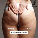 Антицелулитен и моделиращ лосион - Image 2