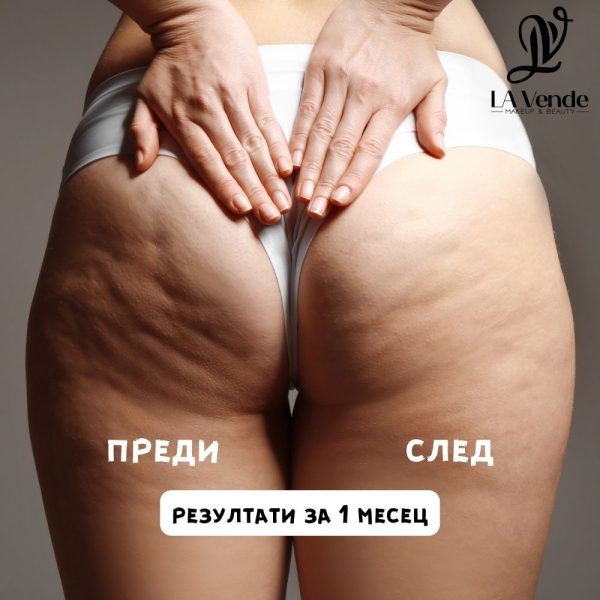 Антицелулитен и моделиращ лосион - Image 2