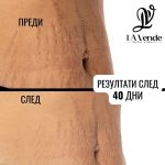 Анти стрии с какао и карите - Image 3