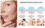 omo bg anti acne patch 02