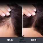 omo bg shampoan protiv kosopad kopriva hmel 01