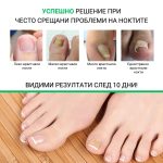 omo bg plastiri protiv vrastnali nokti 04
