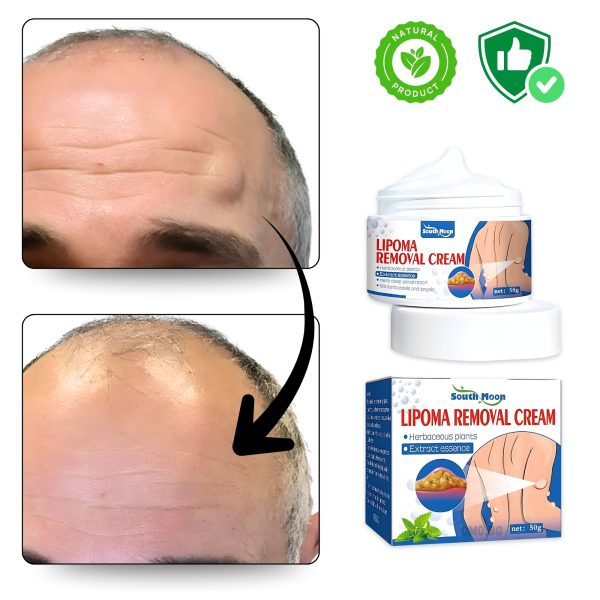 omo bg krem za lechenie na lipomi lipocream koncentriran 04