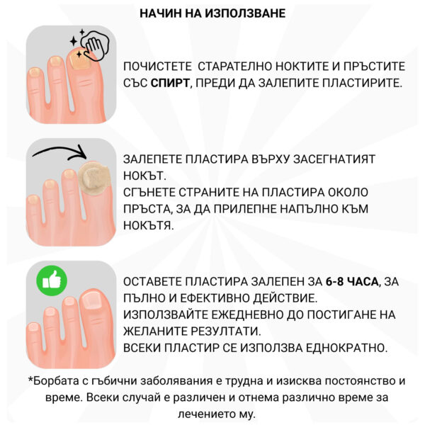 omobg hidrogel plastiri za nokti s nano srebro protiv gubichki i63436 684