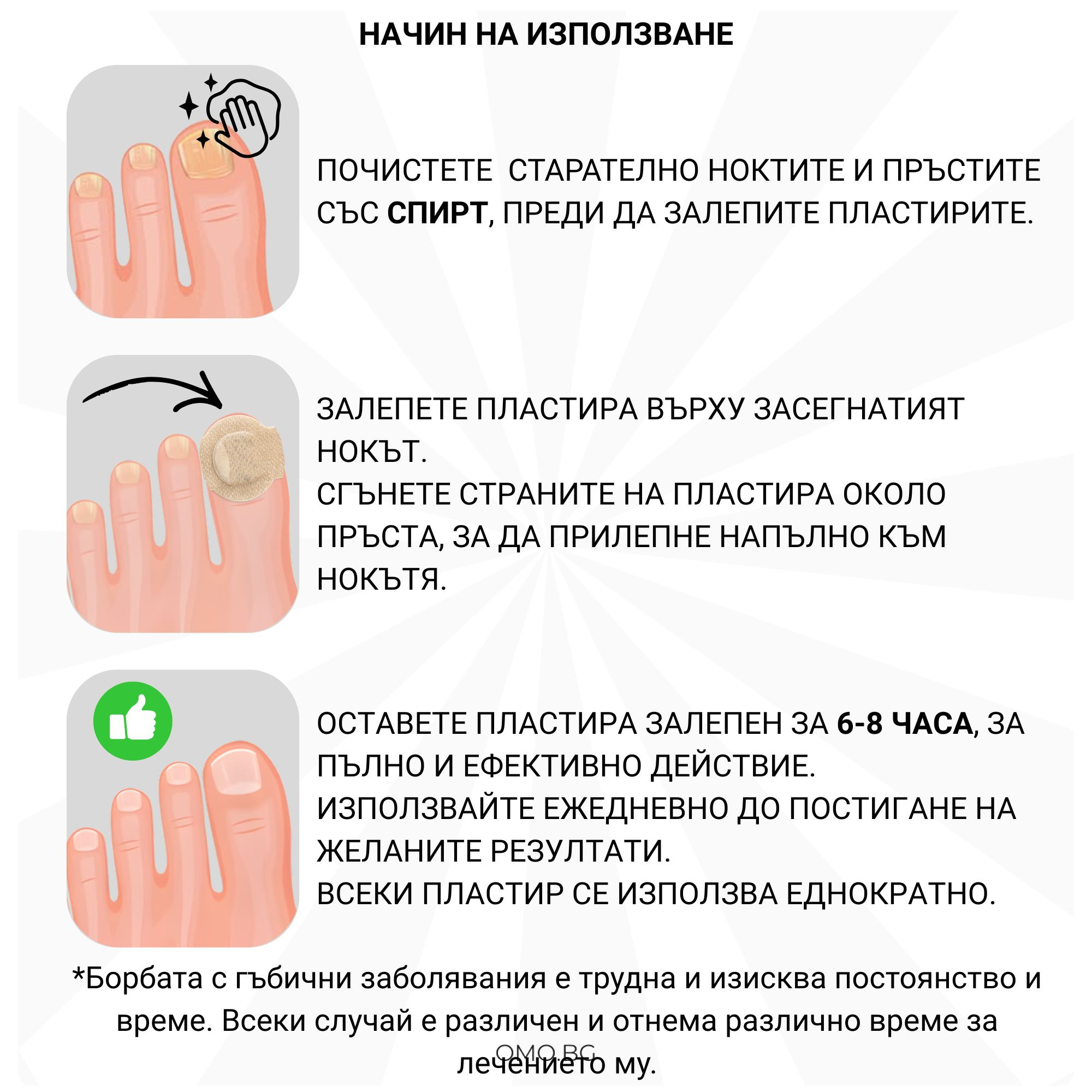 omobg hidrogel plastiri za nokti s nano srebro protiv gubichki i63436 684